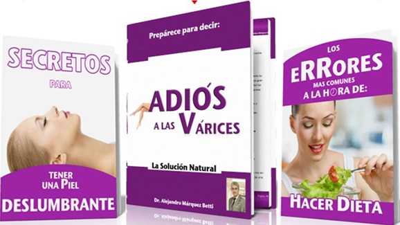 Adiós a las Varices