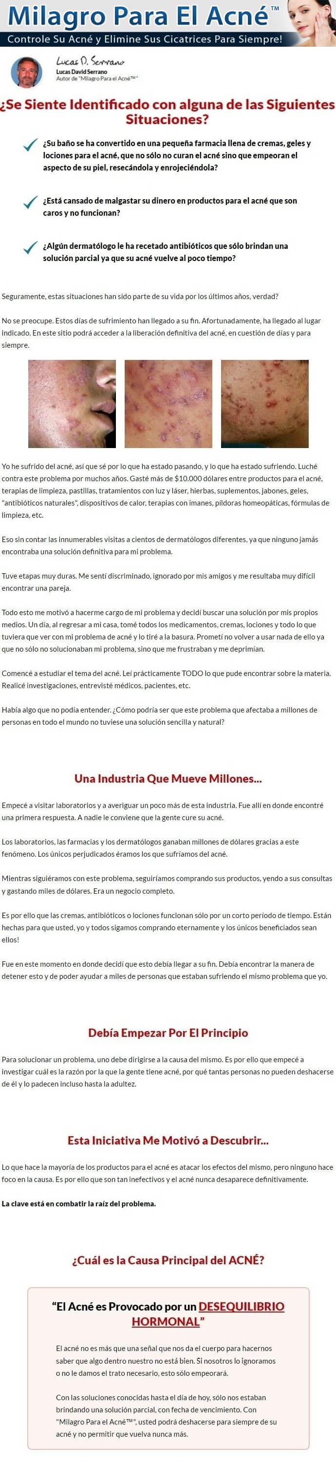 Milagro para el Acne Pallaz 01