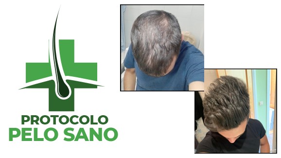 Protocolo Pelo Sano
